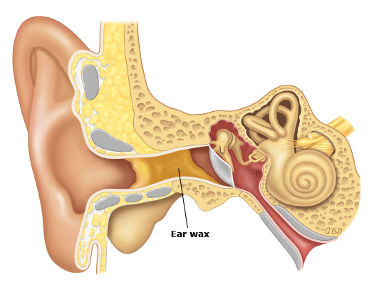 Impacted Ear Wax | Essential Therapeutic Bodywork